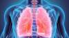 5 Kebiasaan Buruk yang Dapat Mempengaruhi Kesehatan Paru-paru