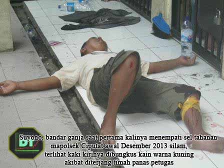 Suyono bandar ganja saat pertama kalinya menempati sel tahanan mapolsek Ciputat awal Desember 2013 silam terlihat kaki kirinya dibungkus kain warna kuning akibat diterjang timah panas petugas