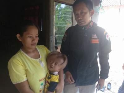 Balita Penderita Hydrocephalus di Lebak Butuh Bantuan Dana