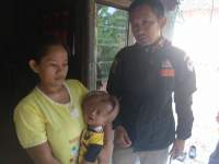 Balita Penderita Hydrocephalus di Lebak Butuh Bantuan Dana