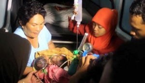 Bayi Berkepala Dua Meninggal Dunia