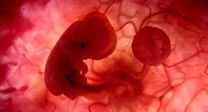 Ilustrasi. (Pallcare)