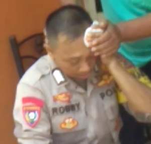 Anggota Bhabinkamtibmas Desa Kadu Terluka Terkena Sabetan Pisau