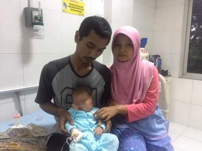 Bayi Tanpa Kelopak Mata di Balaraja Butuh Bantuan