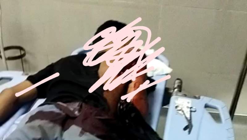 Tiga Siswa SMA Cisoka Terkapar Disabet Senjata Tajam