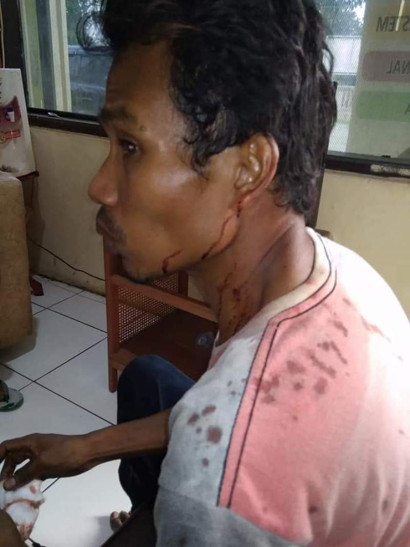 Warga Pagedangan Ilir Babak Belur dikeroyok Preman Parkiran Jembatan Lontar