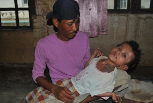 Anak 12 Tahun Menderita Gangguan Saraf Leher