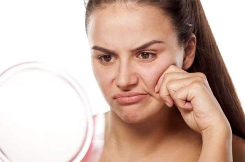 Cara Atasi Minyak Berlebih pada Wajah dengan 3 Bahan Alami Berikut