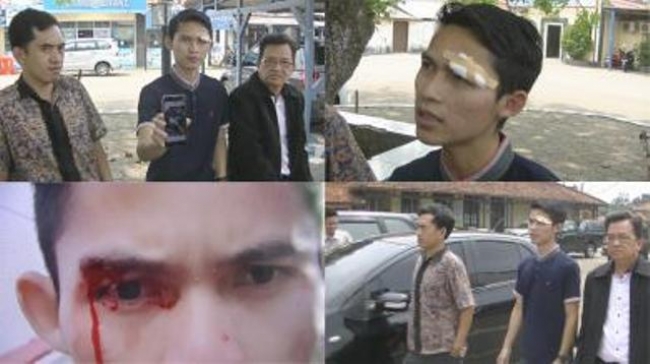 Aniaya Warga Pandeglang, Anggota DPRD di Laporkan Ke Polres Serang