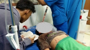 Korban Tawuran saat di ICU RSUD Kota Tangerang dan akhirnya menghembuskan naps pukul 19.30 Wib