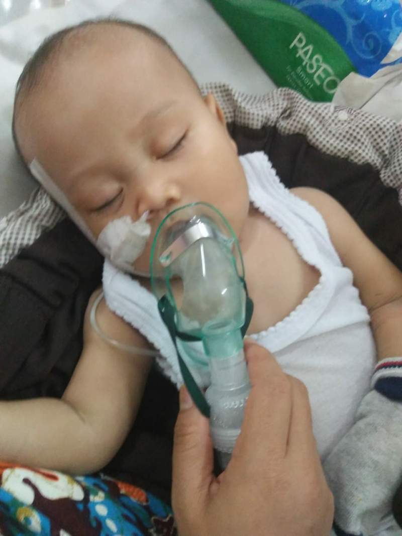 Balita Penderita Tumor Di Lebak Butuh Perhatian